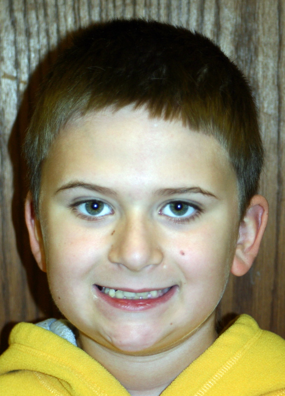 4BLC